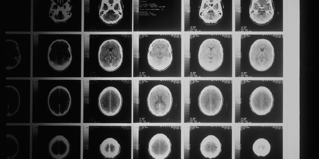 a black and white photo of various mri images